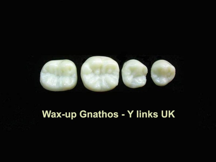 Wax-up Gnathos Quadrant