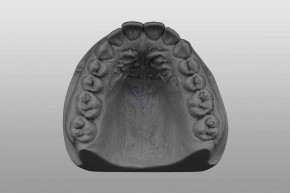 Study-Model upper jaw Q14 grey