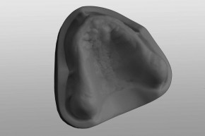 Study-Model upper jaw Z5 grey